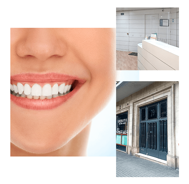 Clínica Dental Dr. Seguí Lanfranco es un reconocido centro de Odontología y Estomatología, ubicado en pleno centro de Barcelona.